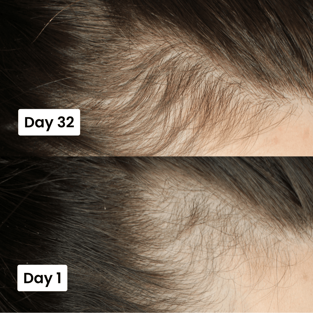 Best Scalp Hair Growth Serum With Free Home Delivery