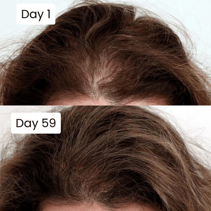 Best Scalp Hair Growth Serum With Free Home Delivery