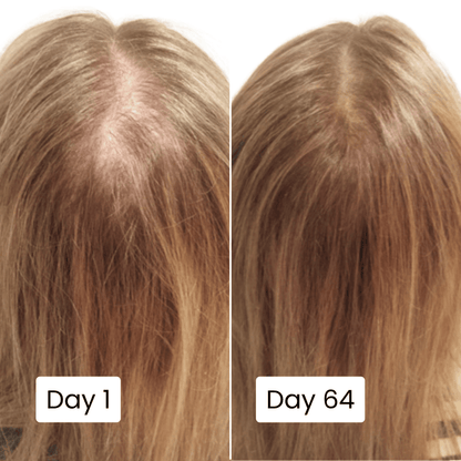 Best Scalp Hair Growth Serum With Free Home Delivery